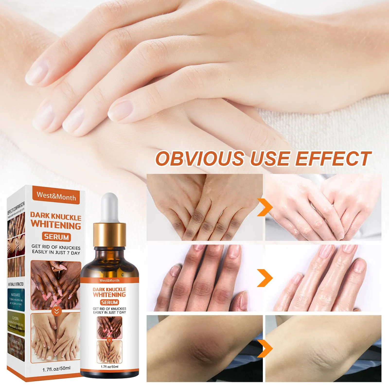 West&Month Skin Beauty Essence Brightens skin tone, knees and ankles, removes melanin, moisturizes, moisturizes and rejuvenates the skin