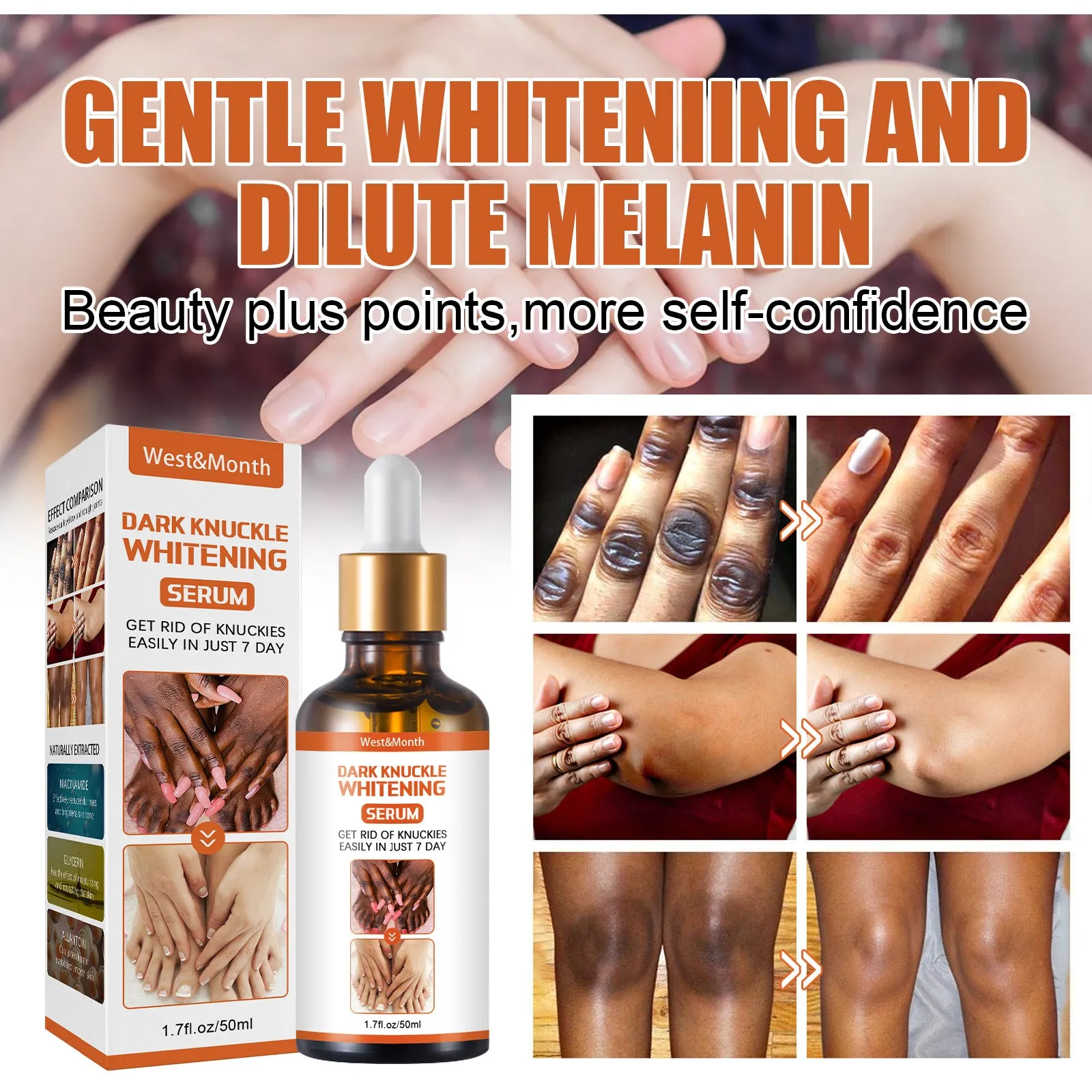 West&Month Skin Beauty Essence Brightens skin tone, knees and ankles, removes melanin, moisturizes, moisturizes and rejuvenates the skin