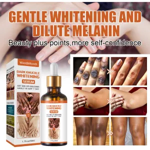 West&Month Skin Beauty Essence Brightens skin tone, knees and ankles, removes melanin, moisturizes, moisturizes and rejuvenates the skin